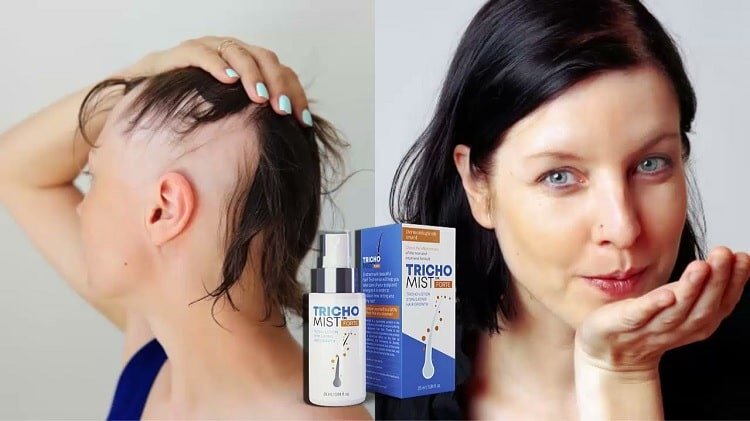 Learn about trichomist forte allegro